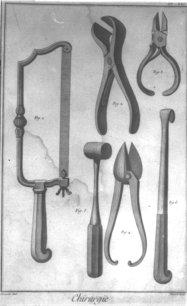 Chirurgie, zes instrumenten van chirurgiegereedschap zoals dat aan boord werd gebruikt, gravure, 18e eeuw.